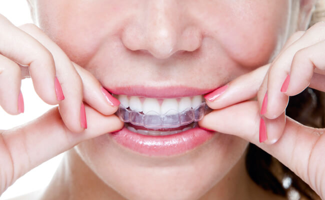 Sky Dream Clinic: First in the Baltics to offer innovative orthodontic treatments