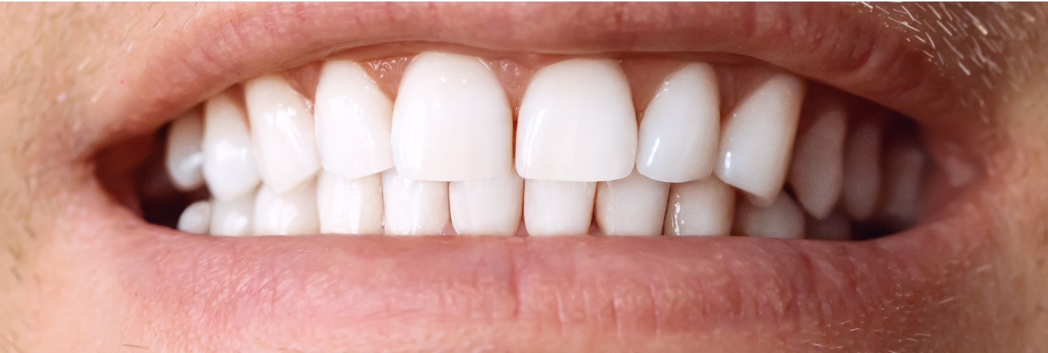White 2 after