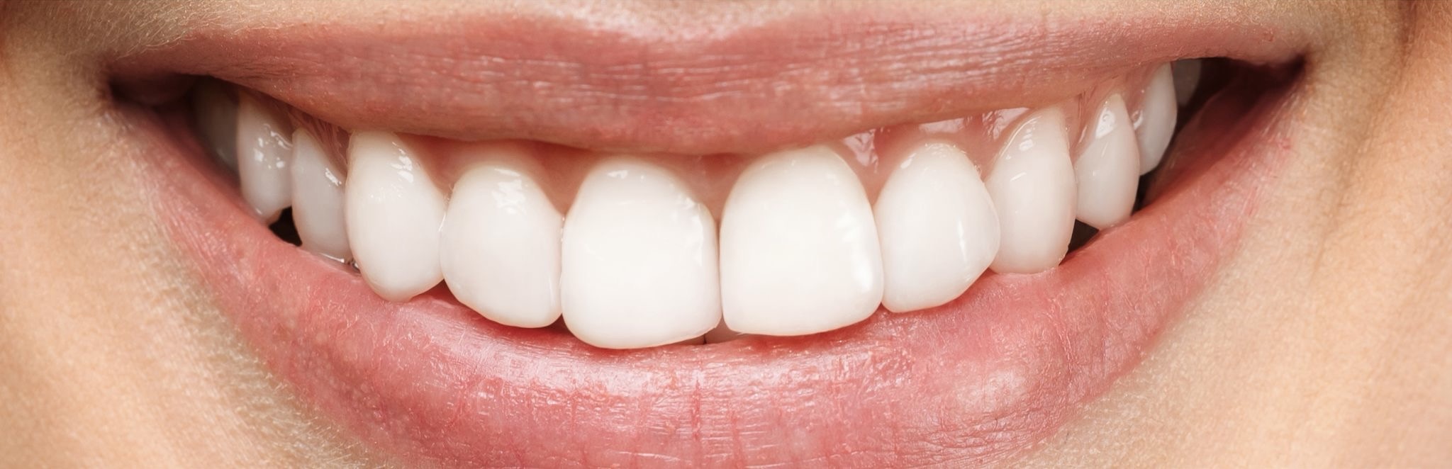 White 1 after