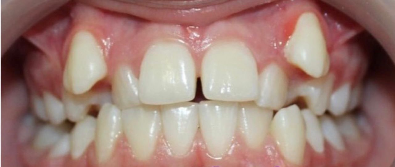 Orthodontics Department Nr.2 before