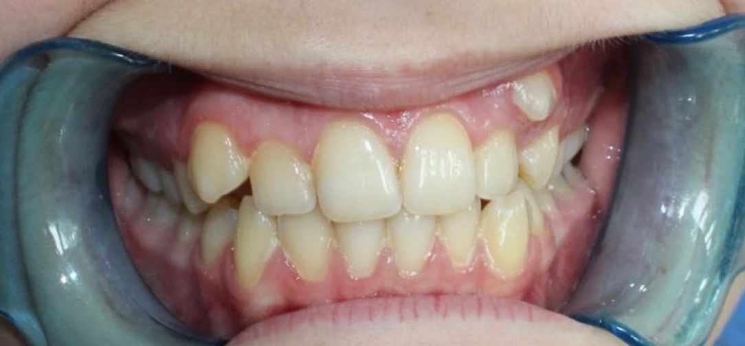 Orthodontics Department Nr.3 before